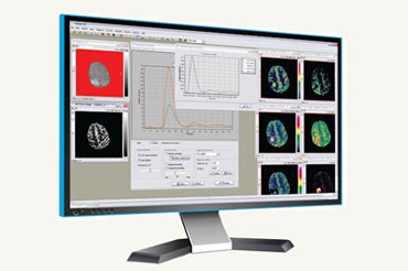 nordicICE臨床科研灌注後處理軟件